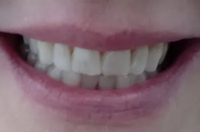 Before image